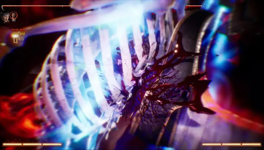 Un terrificante mortal kombat fatality: le costole si frantumano sotto un fascio di luce blu, rivelando un interno sanguinolento.